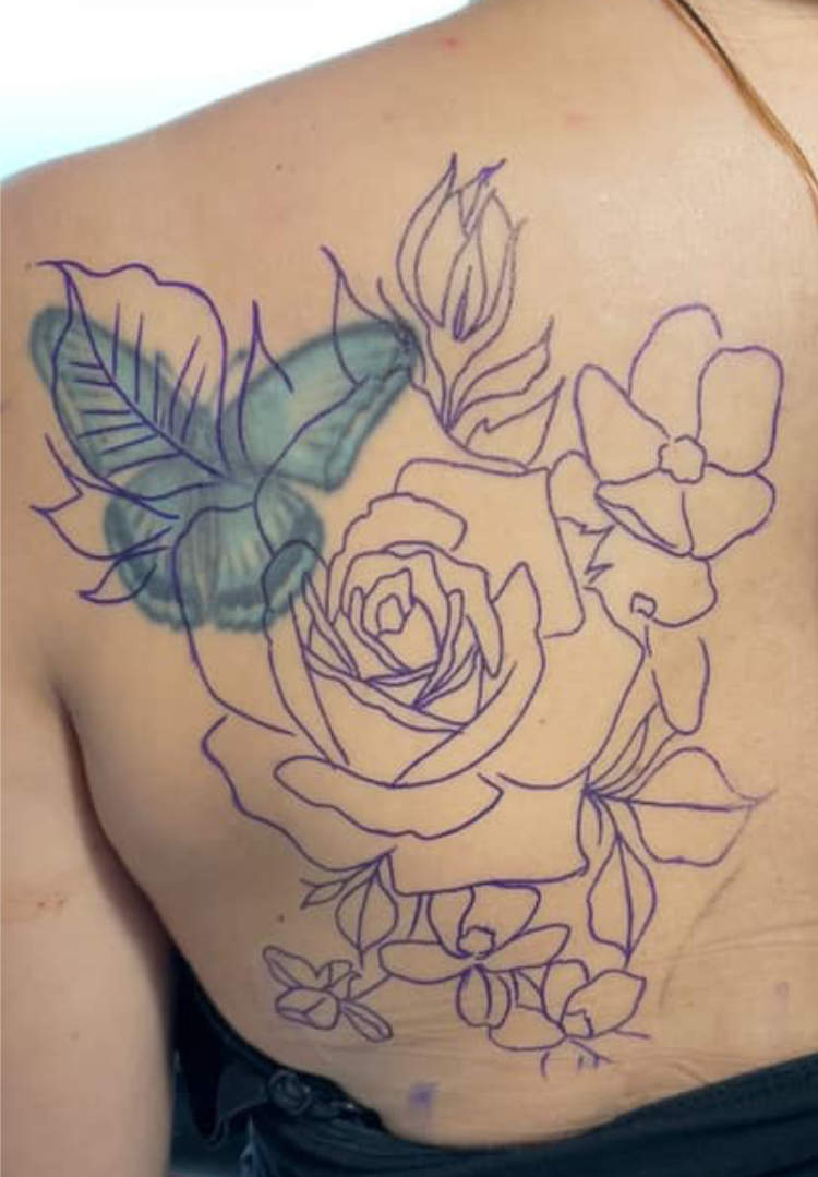 CoverUp 001 before Cover up Tattoo before